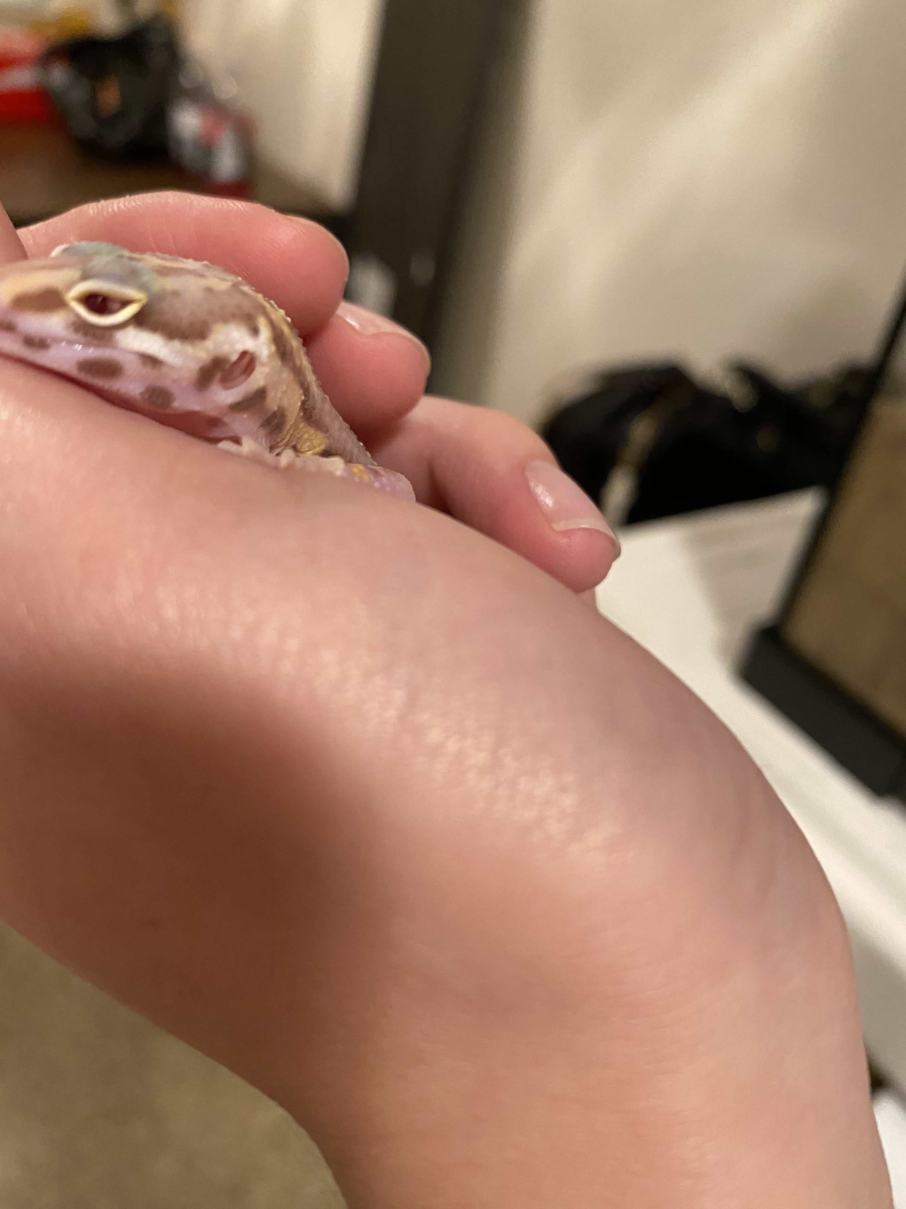 Noodle (blind albino leopard gecko)